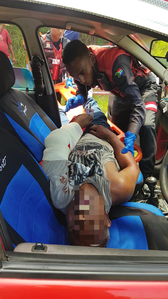 Employees Arm Almost Severed During Year End Function: Hazelmere Dam - KZN