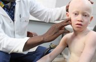 New skin cancer campaign to assist people living with albinism
