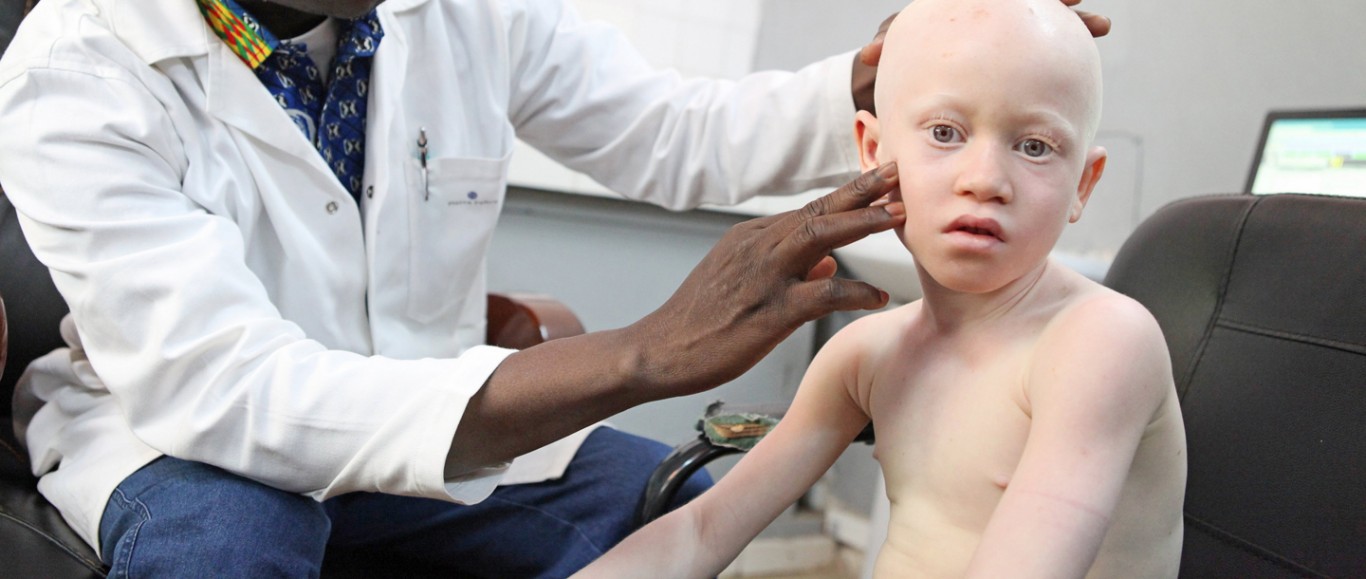 New skin cancer campaign to assist people living with albinism