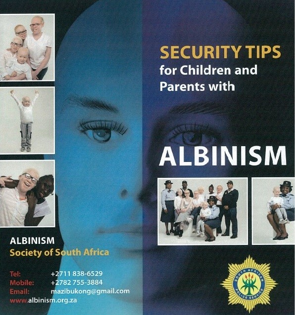 Today is International #AlbinismAwarenessDay. Know More and Be Safe!!