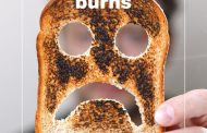 What are the most common types of Burns and how do we treat them?