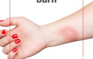 What is the Difference between a Superficial / First-degree burn and a Partial-thickness or second-degree burn?