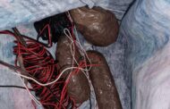 A 55-year-old man was arrested for alleged possession of illegal explosives