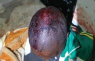 Woman assaults man with frying pan in Hilltop