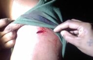 Fisherman stabbed during a robbery in Umhlanga