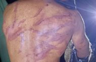 Thief tortured in Durban