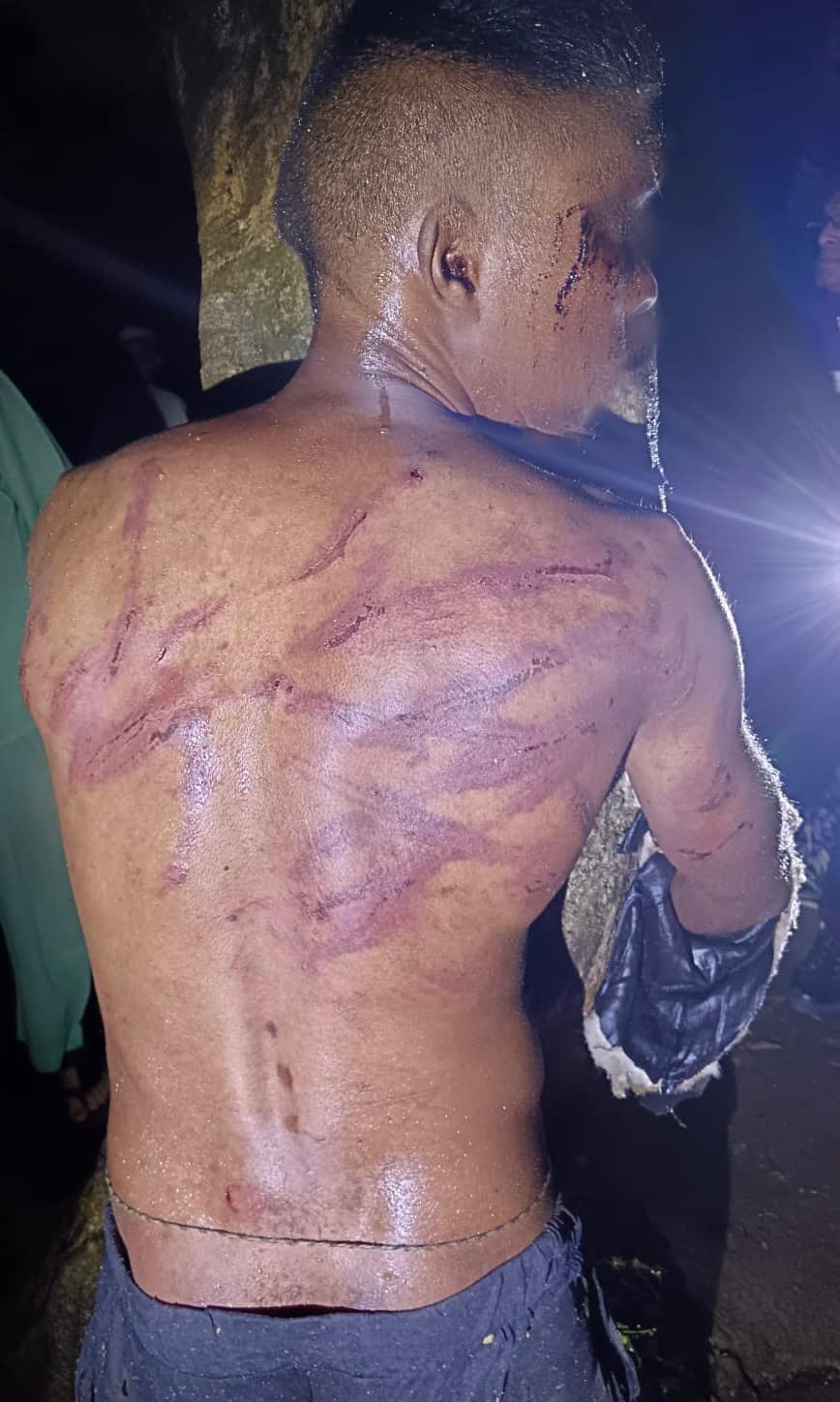 Thief tortured in Durban