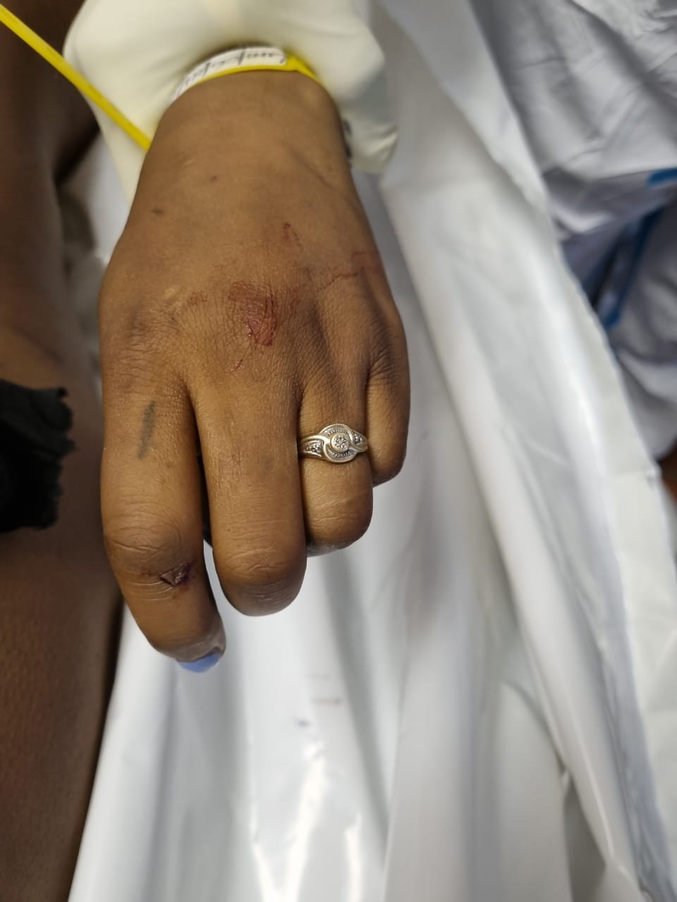 Bela Bela Detectives appeal for information to identify female deceased in apparent hit-and-run accident