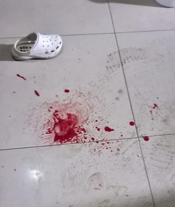 Father and daughter injured during home invasion in Hazelmere