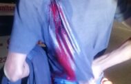 Pedestrian Stabbed During Robbery: Phoenix - KZN