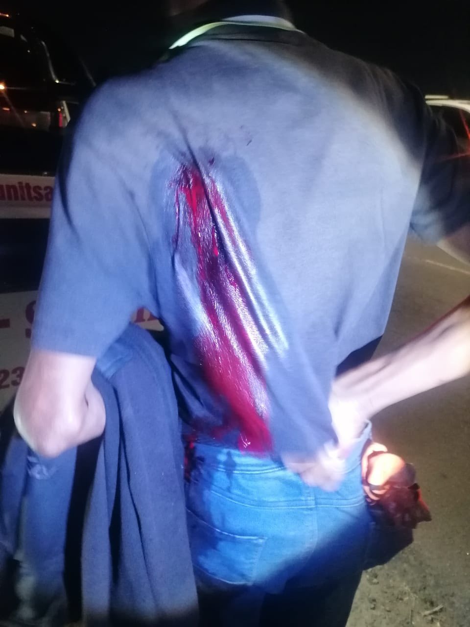 Pedestrian Stabbed During Robbery: Phoenix - KZN