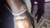 Man Sustained Burns In House Fire: Mtomba - KZN