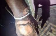 Man Sustained Burns In House Fire: Mtomba - KZN