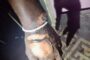 Man Sustained Burns In House Fire: Mtomba - KZN