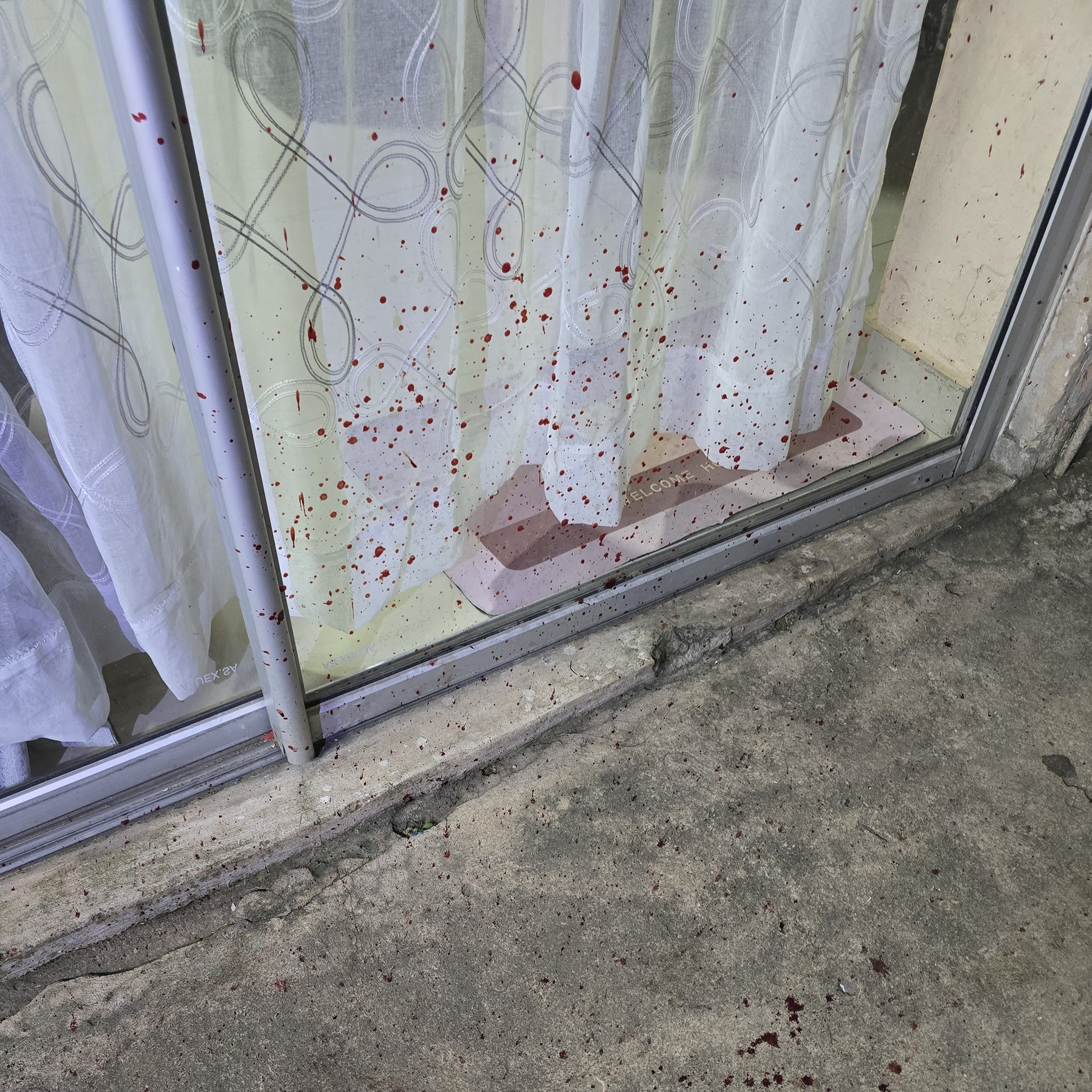 Pitbull Attack on Homeowner Rockford Drive, Phoenix